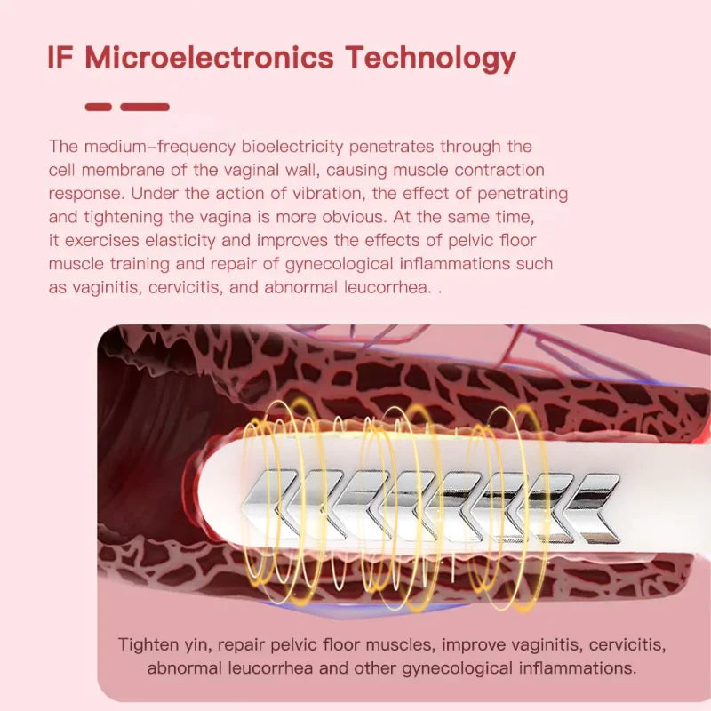 Pelvic Floor Repair Device